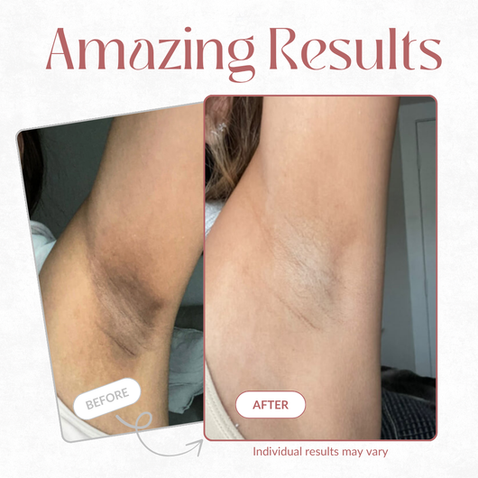 Nuvitall Peel Shot - Kojic + Turmeric Body Peel Spray