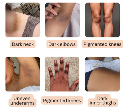 Nuvitall Peel Shot - Kojic + Turmeric Body Peel Spray